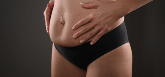 Mommy Pooch? Did your stomach never go back to normal after kids?, Pelvic Floor & Women's Health